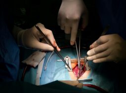 Aortic surgery