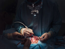 Dr. Vincenzo Giordano - Aortic Surgery